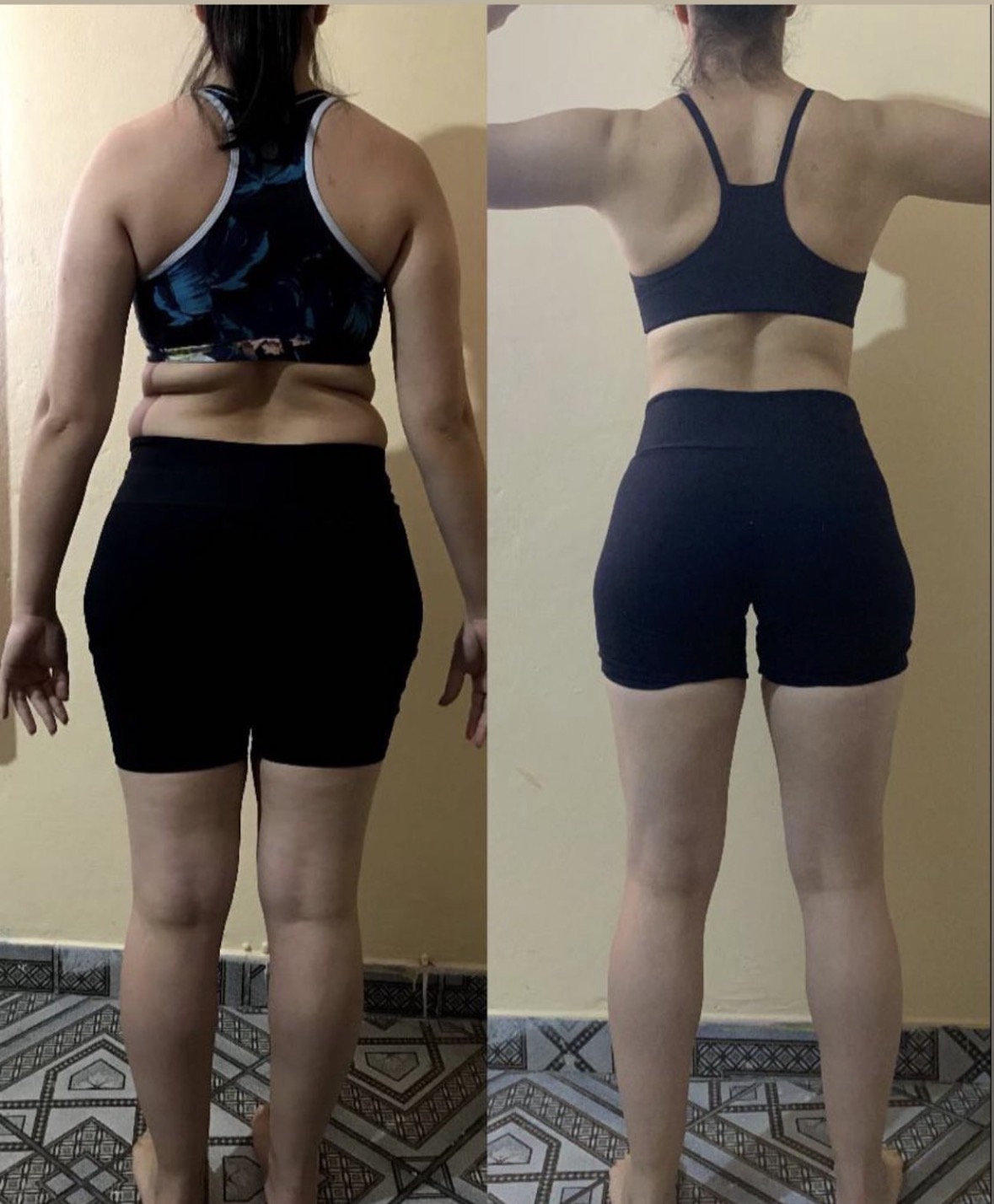 Gordura localizada eliminada